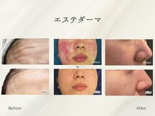 ホリスティックサロン ヘルバ(Holistic salon Herba)/エステダーマ