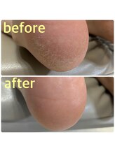 リゼラアンドコー 柏原店/ツルふわかかとケア！