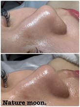 ナチュールムーン(Nature moon.)/毛穴洗浄
