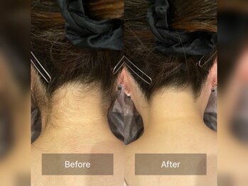 デトックススパボディーラボ/やりたい所30分脱毛打ち放題☆