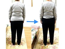 エスコート芦屋サロン/背中のハミ肉取れました