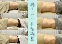 カナロア(Kanaloa)