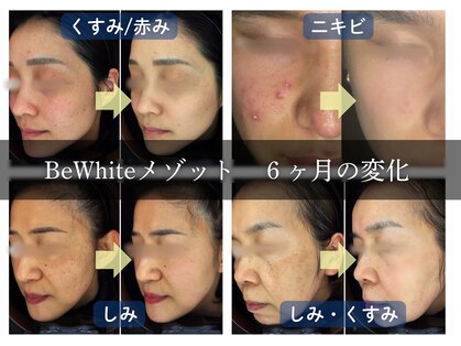 ビーホワイト(BeWhite)の写真