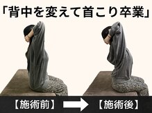 パルマ なかもず(Palma)/施術