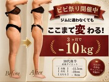 マルデビジュ 西宮(Mar de Bijou)