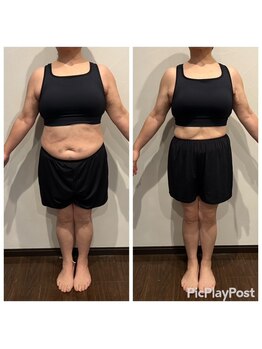 くによし整体院の写真/都城のダイエット専門!30代~60代がウエストー20cm、ー15kg減成功◎夏までに理想の姿へ♪