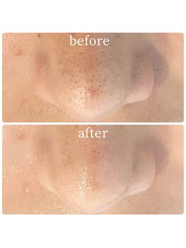 ペイジ(peige)/【peige】症例写真