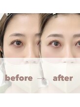 リンク(LINK)/眉毛スタイリング