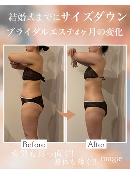 マージェ(magie)/ブライダルエステ