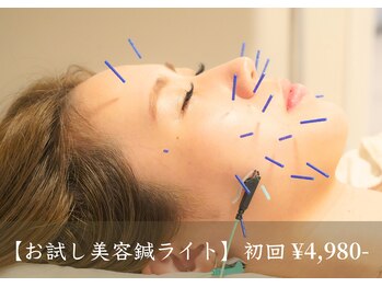 アモ(amo)/お試し美容鍼ライト