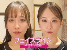 ネルジム 札幌店(NERU GYM)/顔の余白は簡単に減らせます！