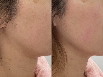 シミケア専門店 SAKURA 平塚店/当事業所は感染症対策を徹底義務