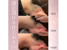 モアトゥインクル 福山宮通り店(MORE twinkle)の雰囲気（後ろから美人に☆彡＃襟足＃うなじ＃ニキビ＃肌育＃肌質改善）