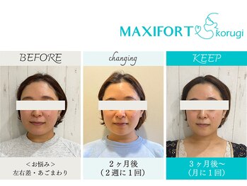 コルギ専門店 マキシフォート 栄店(Maxifort)/お客さまからの感想