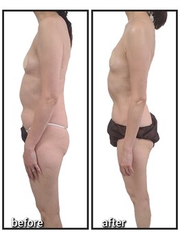 イベリス(IBERIS.)/当店ビフォーアフター