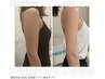 【今月限定】脂肪冷却×高周波×次世代EMS各5回＋酵素135分348,000円→98,000
