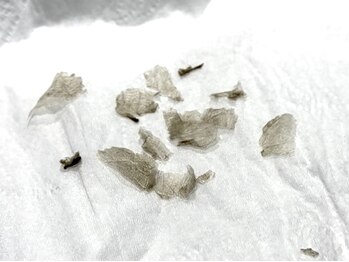 ピンクアンドプラウドサロン 横浜(Pink& Proud Salon)/ローマピンク