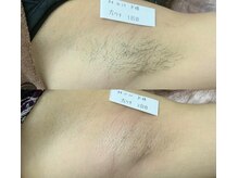 プリマ(Prima)/BEFORE&AFTER