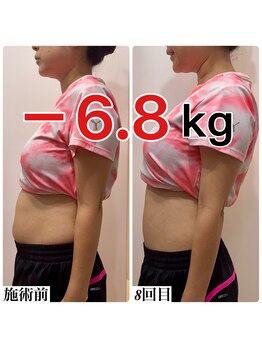 ハリシカ鍼灸院/脇のリンパへアプローチすると