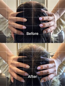 ミームスパ 梅田中崎町(Meem Spa)/【龍の手ヘッドスパ】