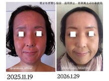 リレフー(Relafy)/★美肌★