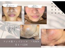 めいてるの雰囲気（もっと身近にエステを！40代、50代のための美活空間☆美肌うる肌）