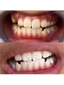 シエル 美里店(ciel)/セルフホワイトニング