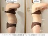 【芯から温め、巡りを良くする！健康的な美しさを】ハイパーナイフ痩身120分