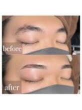 MDラボ 小松清六店/before after