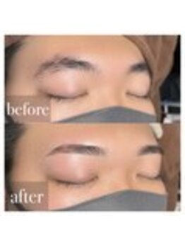 MDラボ 小松清六店/before after