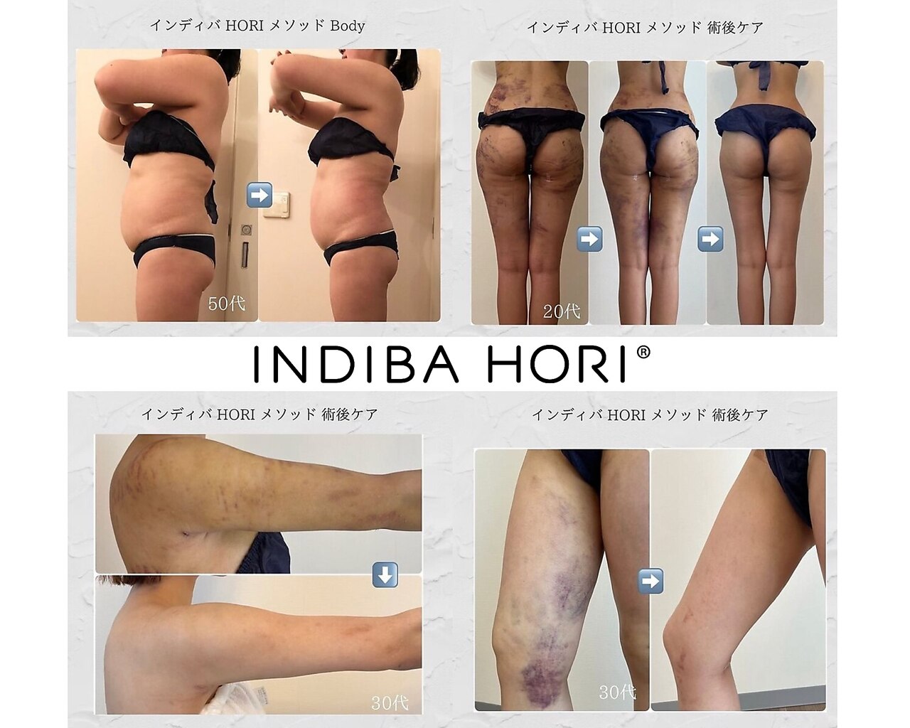 インディバホリトウキョウ(INDIBA HORI TOKYO)｜ホットペッパー