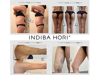 インディバホリトウキョウ(INDIBA HORI TOKYO)の写真