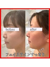 アールズ スリム(R's slim)/フェイシャルも結果重視の専門店