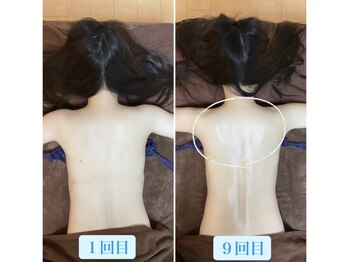 トータルボディケア サニー(TOTAL BODY CARE)/ブライダルエステでボディメイク