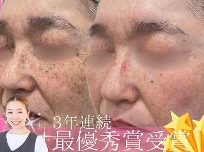 ハウオリ(HAUOLI)の写真