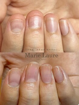 マリーロール 淀屋橋本店(Marie Laure)/自爪育成/深爪矯正/ネイルケア