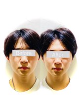 ワカヤマ 小顔(Wakayama)/☆Before・After☆