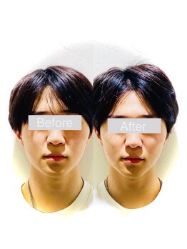 ワカヤマ 小顔(Wakayama)/☆Before・After☆