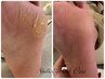 つるつるかかと◆フットケア3300円◆足裏の角質ケアで臭いも撃退！