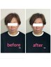 【むくみ・たるみ改善】小顔矯正＋ヘッドスパ90分　¥14000→¥11000