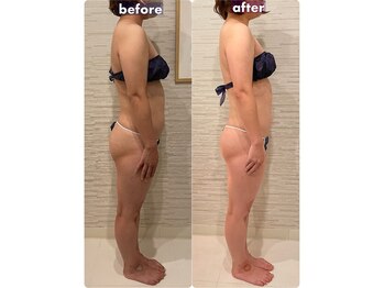 エキュレ ジャーニー トゥ マイ トータル ビューティー(equrer)/コリ・むくみ・姿勢が変わる