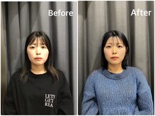 はぐみの杜整骨院 本院/【疲れ顔解消】究極の小顔ケア