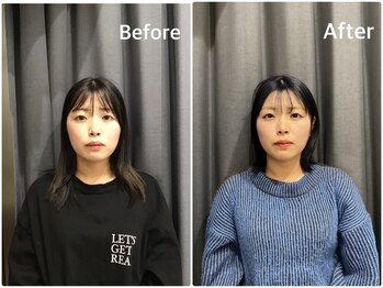 はぐみの杜整骨院 本院/【疲れ顔解消】究極の小顔ケア