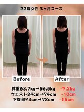 くさば整骨院/32歳女性/ダイエット3か月コース
