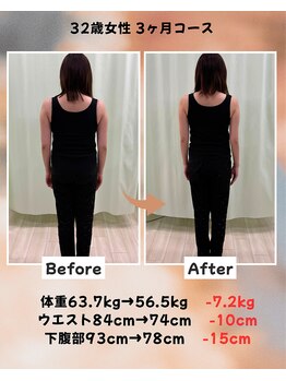 くさば整骨院/32歳女性/ダイエット3か月コース