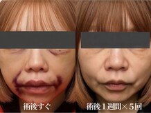 術後インディバ専門サロン 新宿