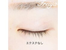 フレイヤ(Freiya)/【3Dミックス】　施術前