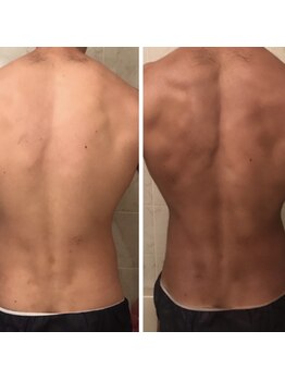 ア レーズ(a laise)/ボディカラーリング☆