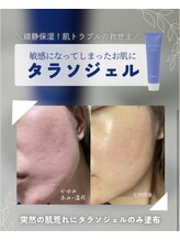 エムグラッティチュード(M gratitude)/