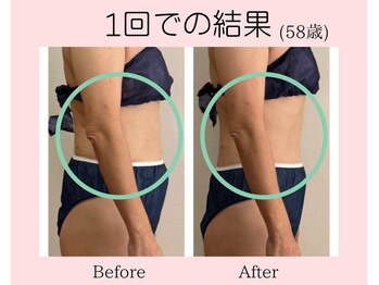 ヨサパーク コクリ(YOSA PARK kokuRi)/背中、二の腕、小尻、美脚に!!